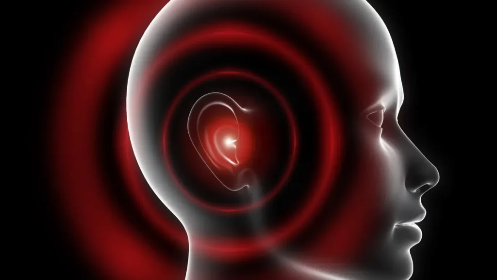 Silen Sense Calm Ears Tinnitus Remedy (AU, CA)